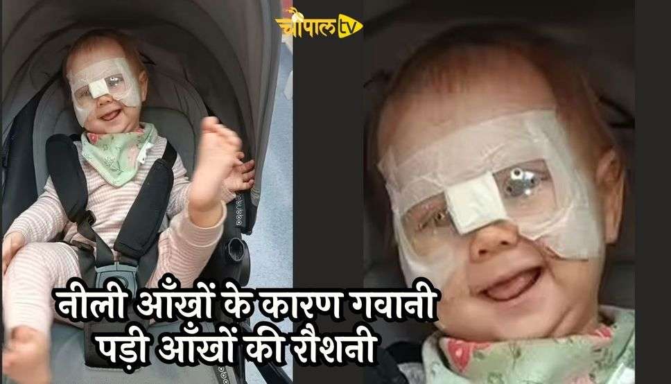 Blue Eye Baby : नीली आंख वाली लड़की पैदा होने पर खुश हुआ परिवार, जब पता चला यह बात, तो फूट-फूटकर रोने लगे मां-बाप