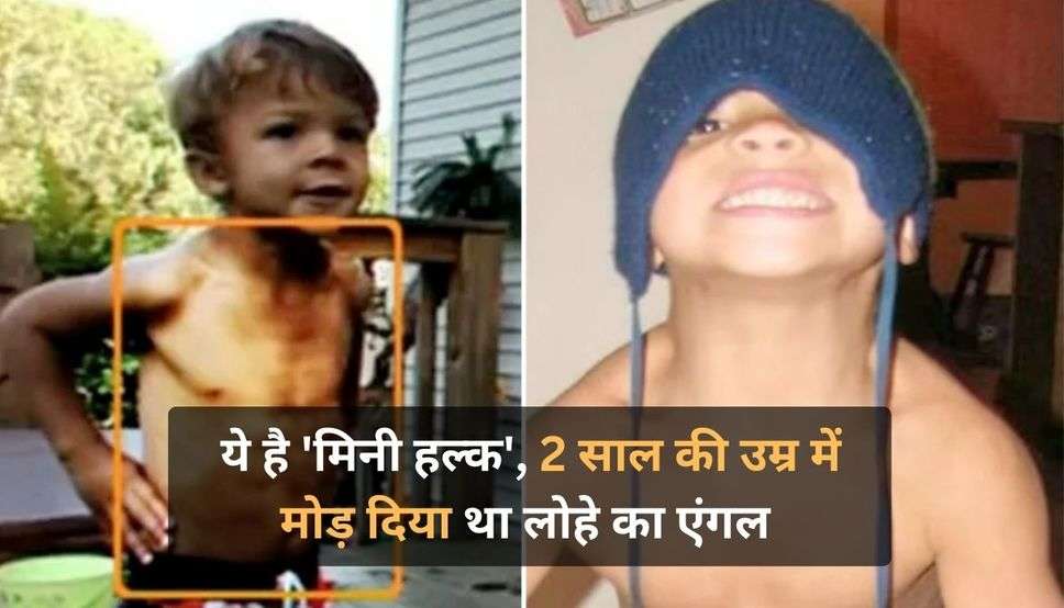 Worlds Strongest Toddler: ये है 'मिनी हल्क', 2 साल की उम्र में मोड़ दिया था लोहे का एंगल,  जानें कैसे